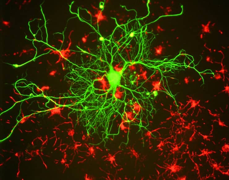 Neurone “colorato” con un anticorpo